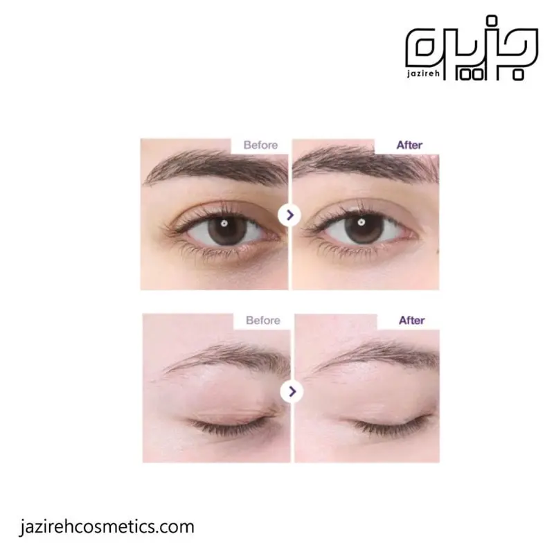کرم دور چشم پپتاید و رتینال شماره 9 نامبوزین ( 20 میل )