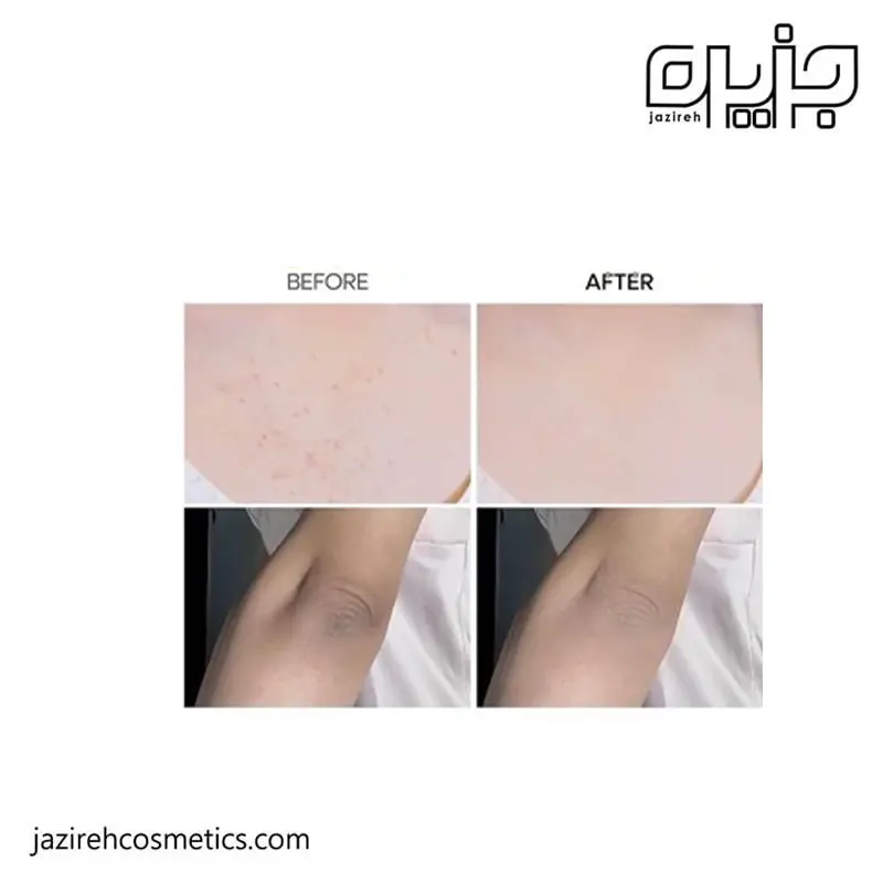 اسپری روشن‌کننده بدن و نواحی تیره کوجیک اسید دکتر ملاکسین