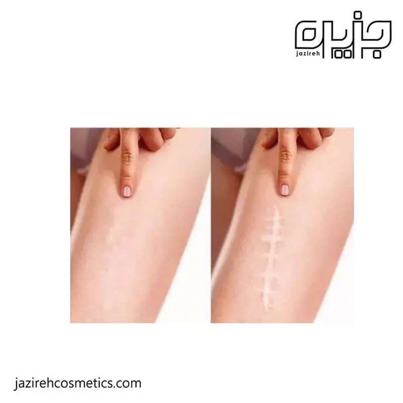 ژل ترمیم کننده سیکالفیت اون ( 30 میل )