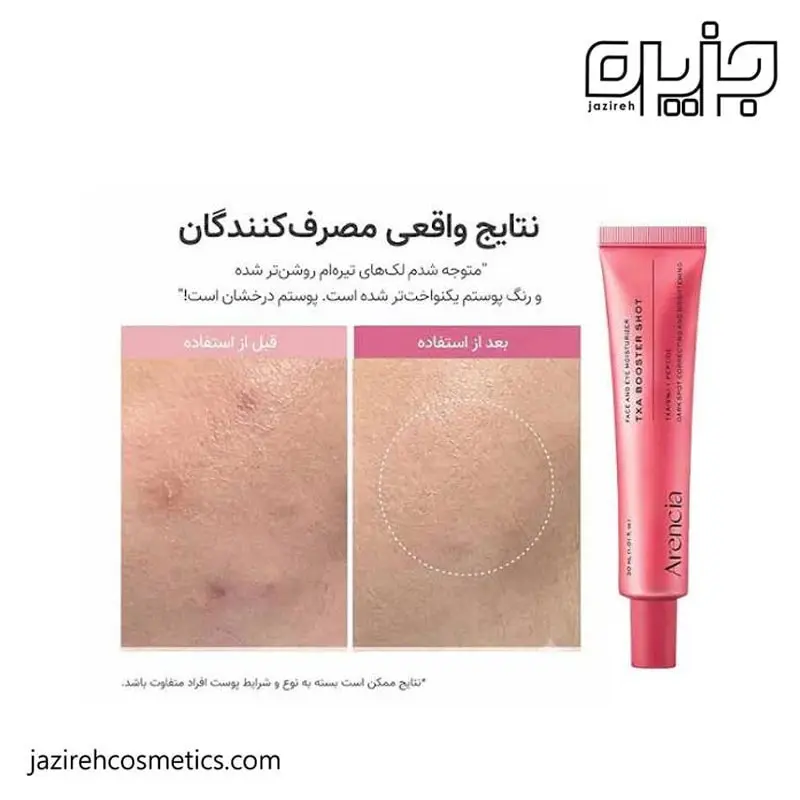 سرم ترانگزامیک اسید آرنسیا مدل بوستر شات